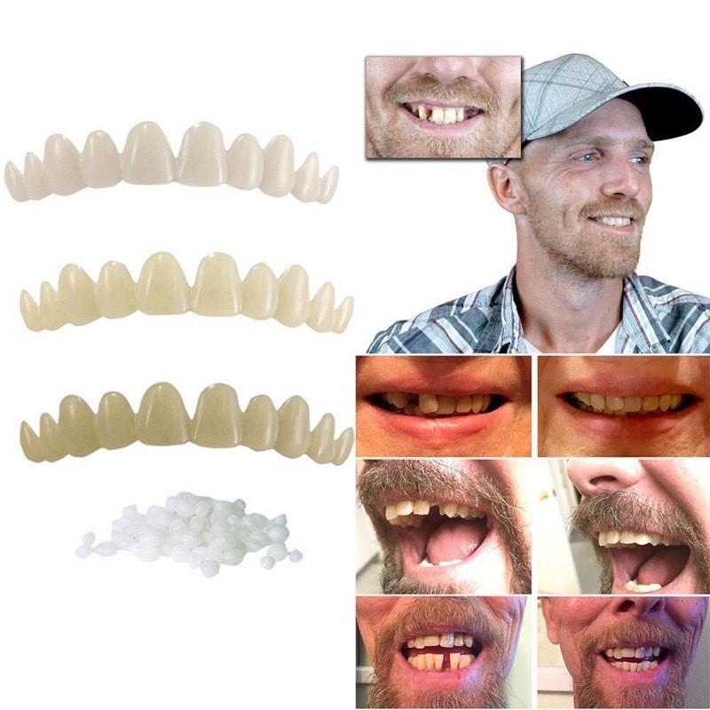 Cross-border snap on smile Whitening silicone simulation denture cover smile instant suction card fake dental sticker