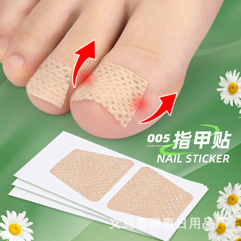 Nail care patch inlaid nail groove into the meat long toe pad protective patch soft nail onychomycosis orthopedic patch wholesale