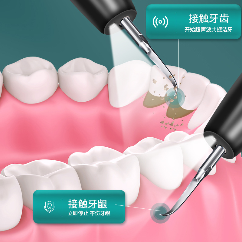 Ultrasonic Household Tooth Cleaner Tooth Cleaner Cleaning Beauty Tooth Cleaner Removal of Dental Calculi Whitening Tartar