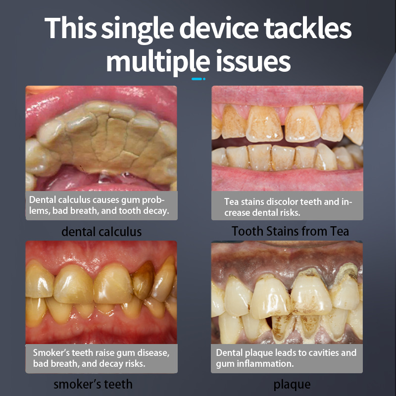 Factory Direct Supply Sonic Toothbrush Electric Toothbrush Unisex USB Charging Removes Dental Calculus Oral Cleaning