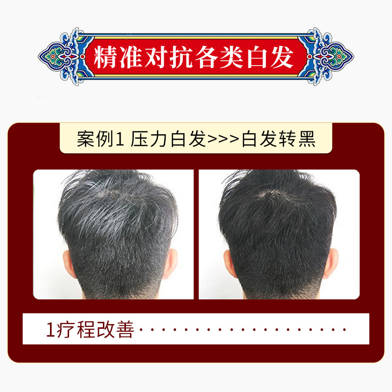 South China Institute of Biomedical Research white hair black hair Medical cold compress gel Polygonum multiflorum liquid scalp care white to black