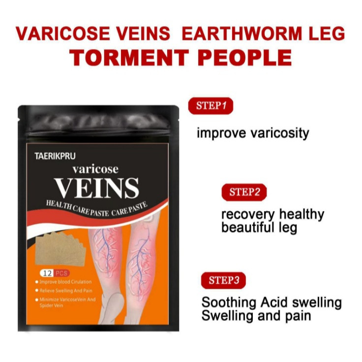 Кросс-бордерный патч для лечения варикозного расширения вен, облегчение боли в выступающих венах ног