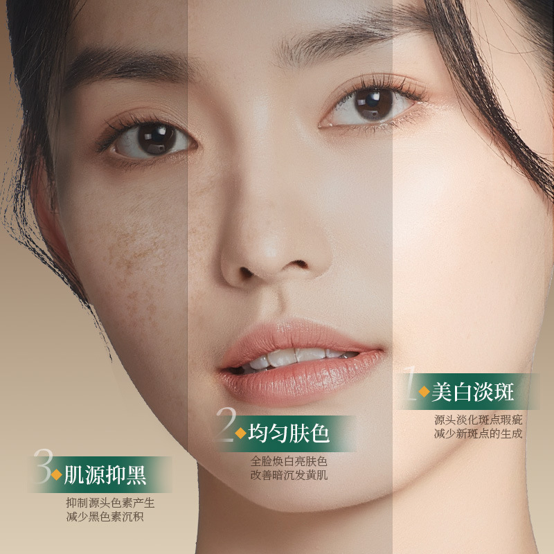 Dr. Perry Whitening and Anti-Freckle Cream for Removing Yellow and Brown Sunburn, Light Melanin Brightening Skin Color Hydrating and Moisturizing Cream