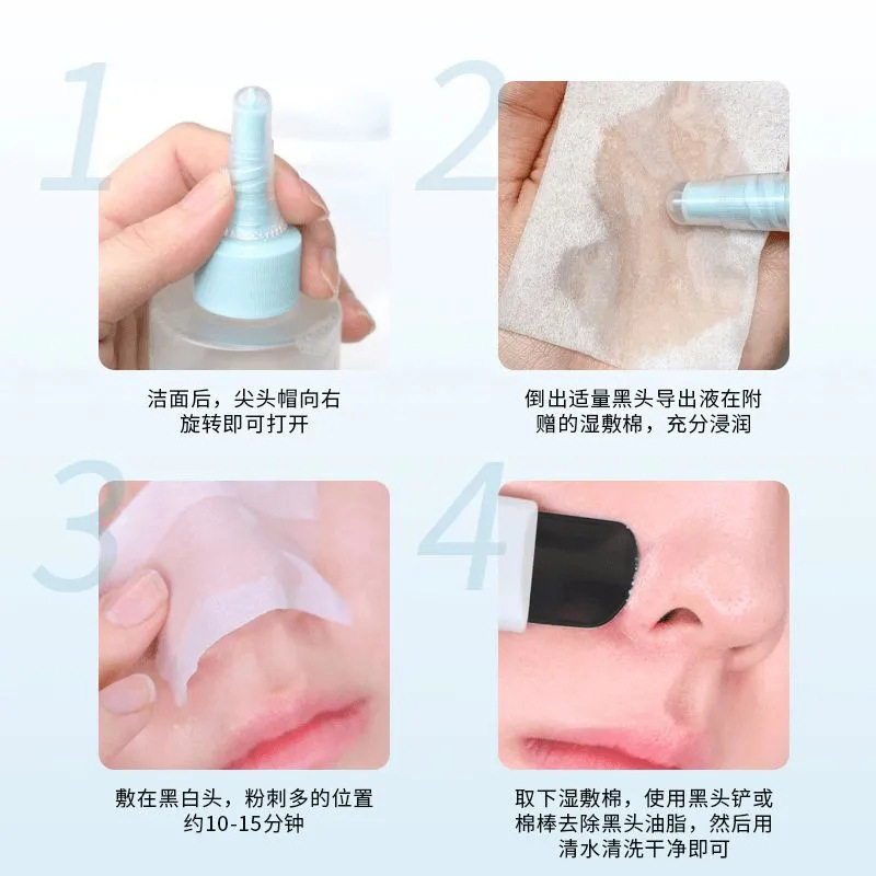 Su Xiu Chen's blackhead discharge liquid shrinks pores deep cleaning acne blackheads closed gentle care does not stimulate