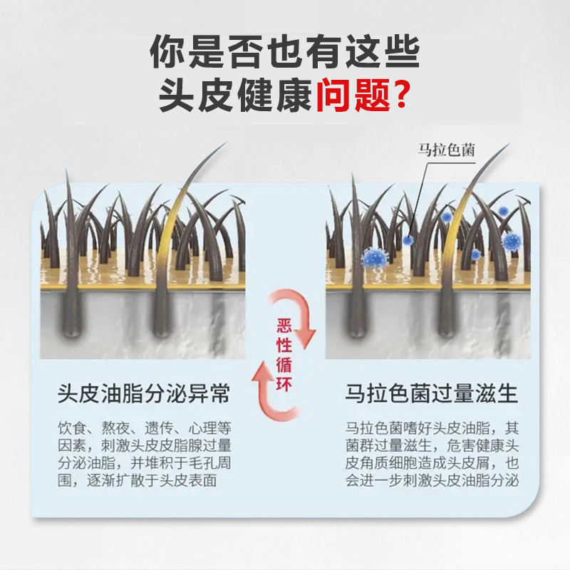 [buy One, Get 2 Bottles Here] Baiyunshan Selenium Disulfide Anti-dandruff Shampoo Is Refreshing, Anti-itching, Oil Control and Fluffy