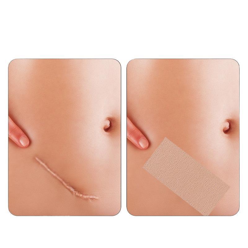 Invisible cut breathable can be attached to the tattoo non-woven fabric can cover invisible self-reuse anti-wear paste