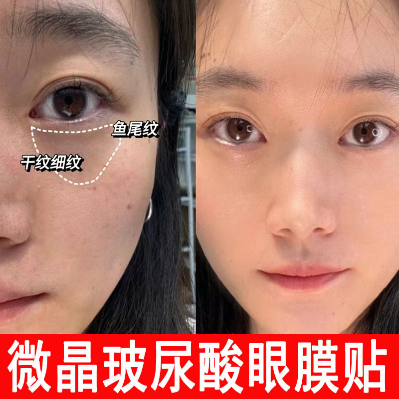 Микроигольчатая Маска Для Глаз Устранение Мелких Морщин Мешки Темные Круги Уплотнение Лифтинг
