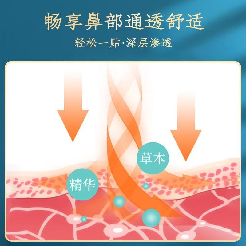 Hong Kong Pharmacy Xanthium Seed Nasal Comfort Patch Runny Nose Patch Nasal Patch Factory Spot One Piece Dropshipping