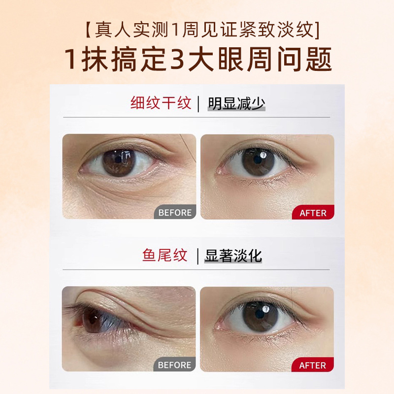 Lutein Essential Oil Anti-Wrinkle, Soothing Dry Eyes, Health Care, Eye Protection, Dark Circles, Lightening Lines, Eye Essence Oil, Massage Oil