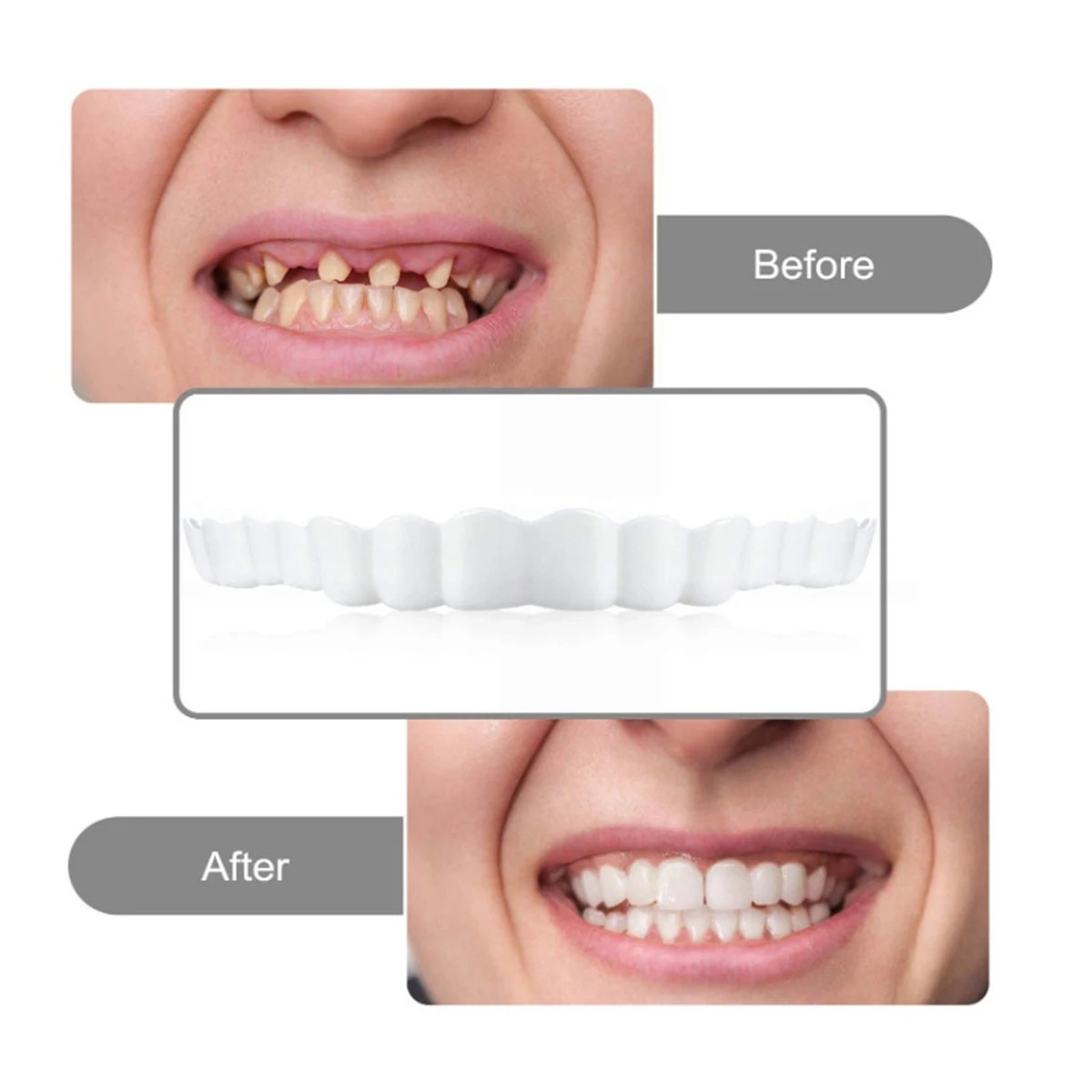 Cross-Border Simulated Braces for Upper and Lower Teeth Second Generation Smile Whitening Temporary Decorative Denture Braces Manufacturer Wholesale