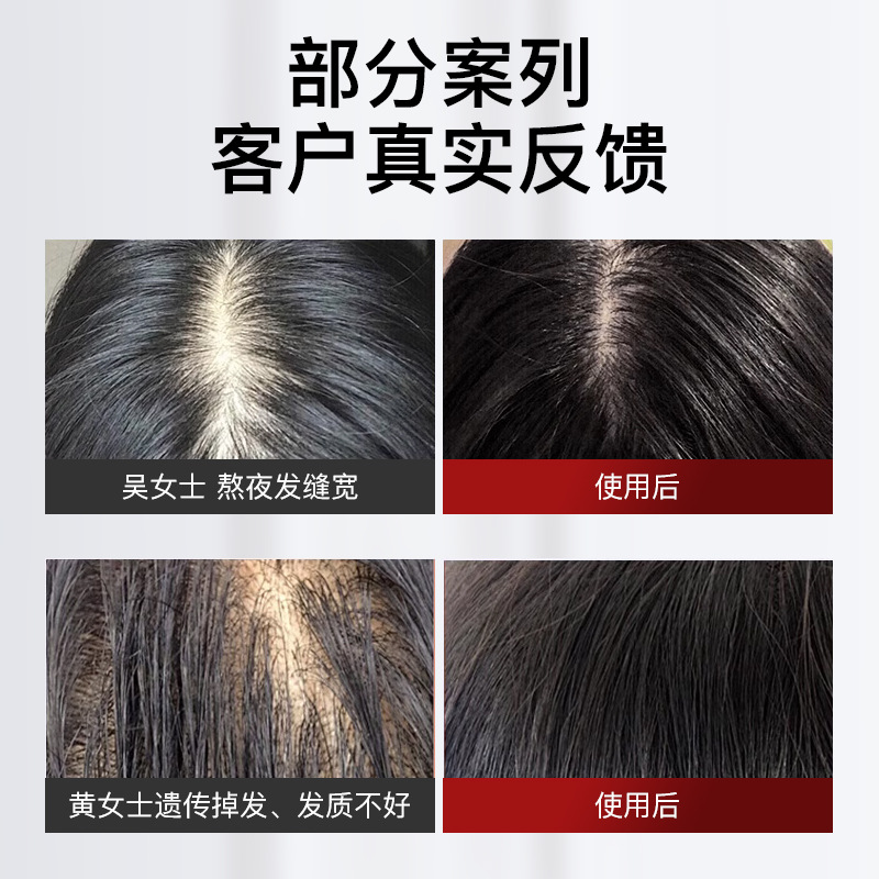Rubbing Hair Growth Comb Scalp Electric Massage Comb Red Light Anti-Density Hair Growth Device Essential Oil Liquid Guide Comb Head Applicator
