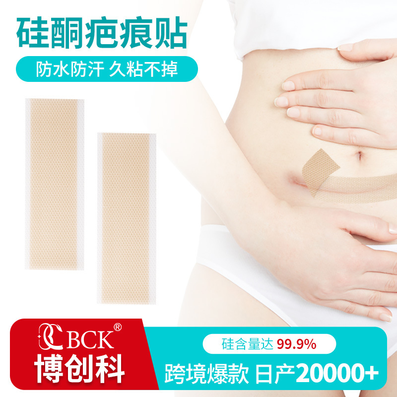 Кросс-бордерный шрамовый пластырь медицинского класса силиконовая обработка послеоперационный шрамовый пластырь водонепроницаемый и потоотталкивающий шрамовый гиперплазийный пластырь