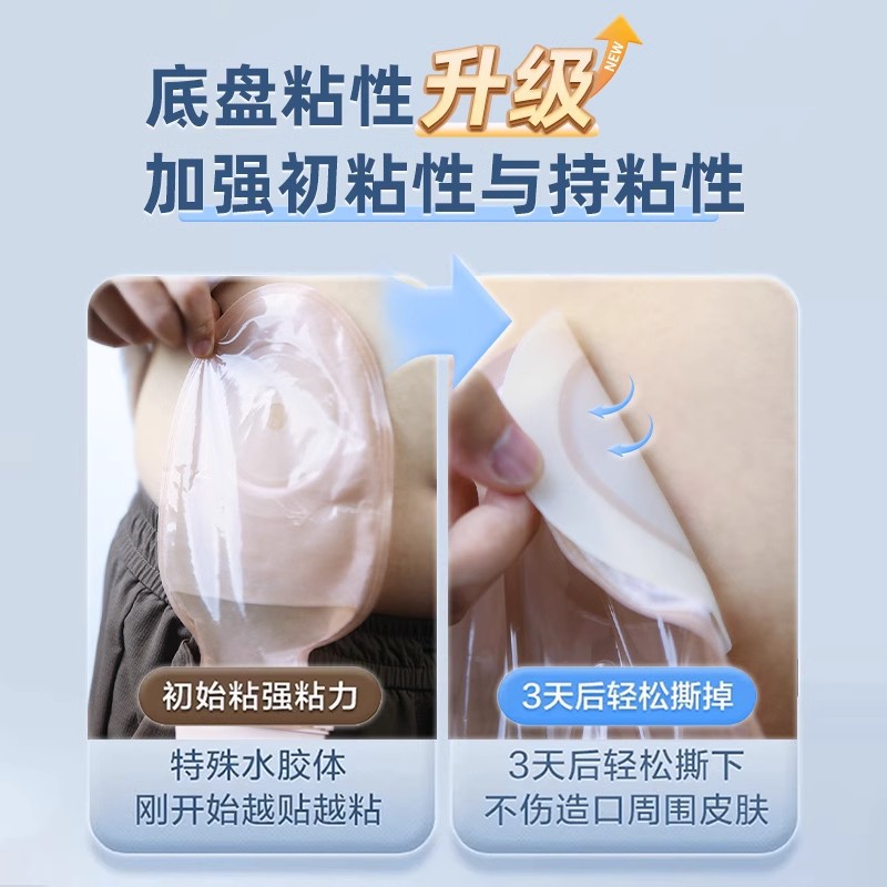 Medical disposable ostomy bag one-piece rectal diversion stool ostomy anorectal bag