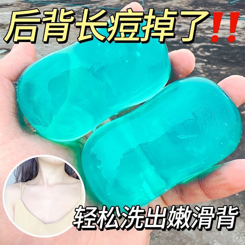 Salicylic Acid Acne Soap Oil Control Acne Deep Cleansing Mites Blackhead Face Wash Soap Wholesale Free Shipping