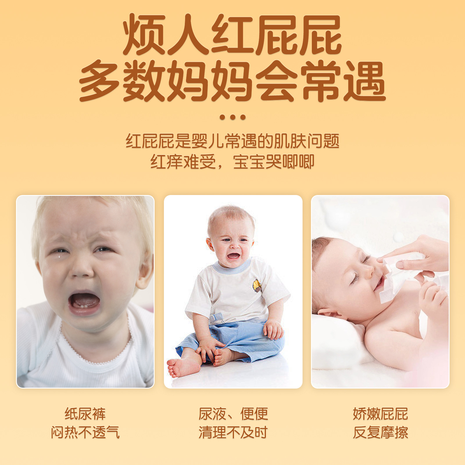 Sunflower wholesale in stock buttock cream anti-red buttock baby special children's buttock cream