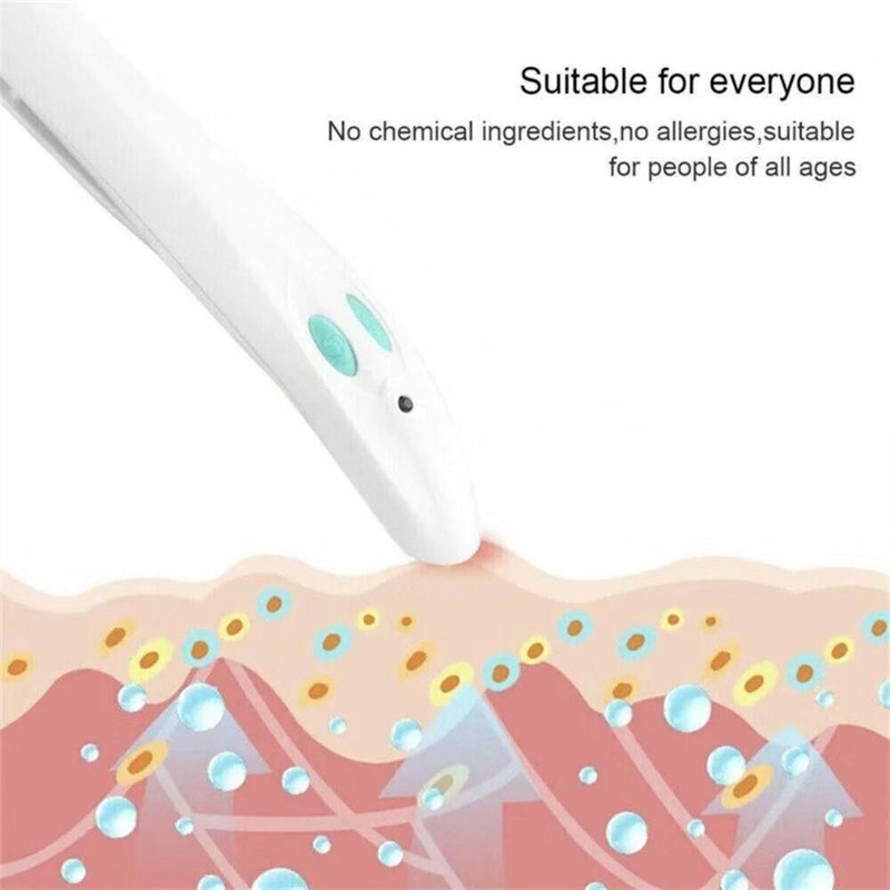 Cross-border in stock Bite Relief Adult Children Physical Portable Mosquito Sticking Antipruritic Pen Mosquito Sticking Antipruritic