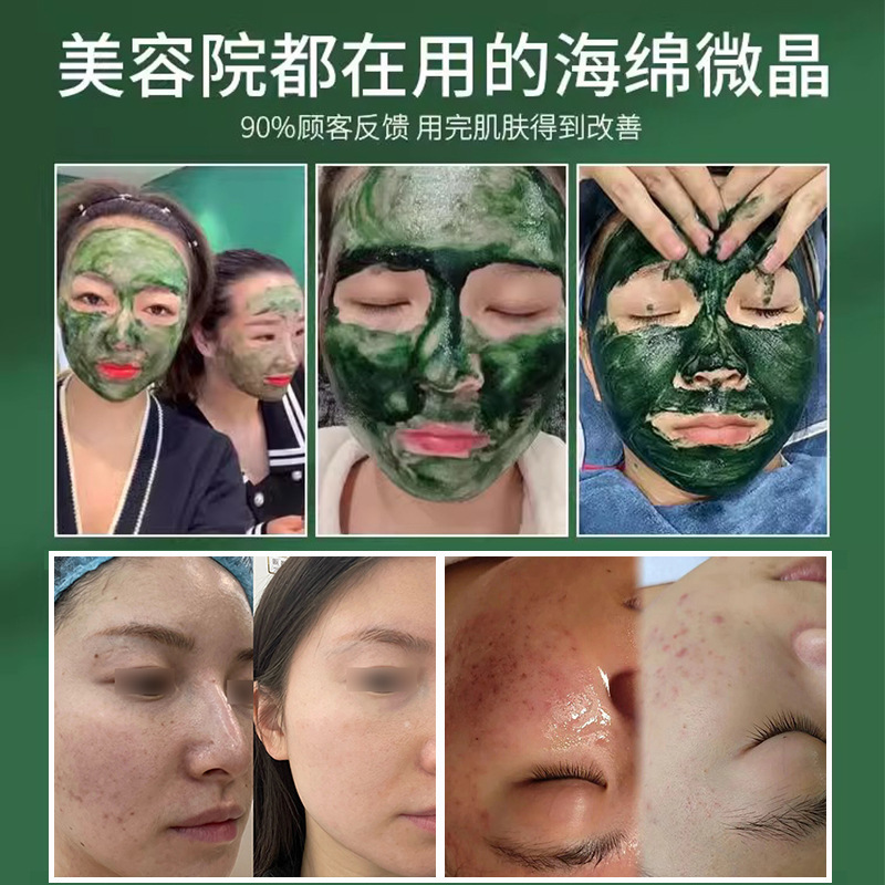 70% Long Needle Sponge Micro-Needle Removes Acne, Fades Acne Marks, Clears Closed Acne, Small Green Film Bone Needle Rejuvenates Skin Set, Beauty Salon