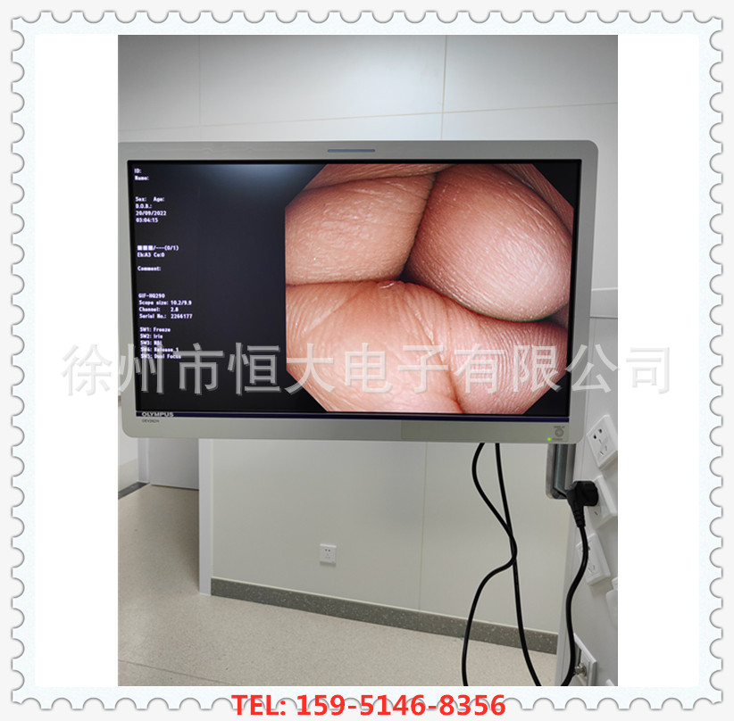 CV-170, гастроэнтероскоп Olympus, цена CF-H170I, HD колоноскопия, GIF-H170, HD гастроскопия