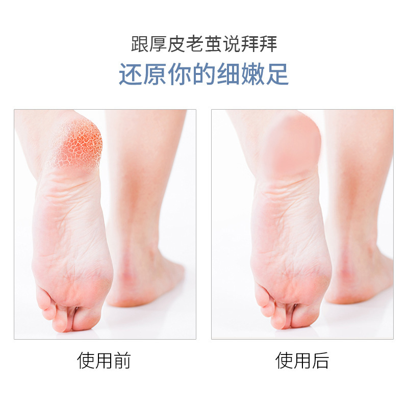 Factory Wholesale Wooden Double-Sided Frosted Foot Scrubbing Board, Thick and Fine Frosted Foot Skin File, Foot Grinding File, Dead Skin Removal Foot Board