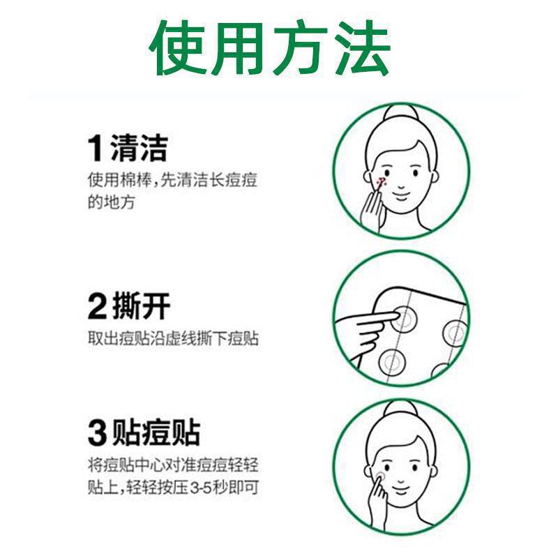 Vt Tiger Acne Patch Has the Same Style as Cica to Eliminate Pus Inflammation, First Aid to Remove Acne, Invisible Patch for Students, Affordable and Authentic