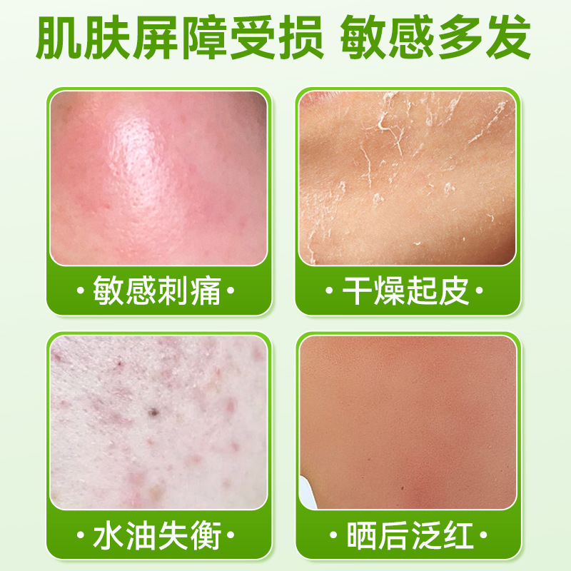 Toneng Medical Aloe Vera Gel Moisturizing Dressing Polyethylene Glycol Medical Dressing Hydrating Moisturizing Repair Barrier Locking Water Soothing