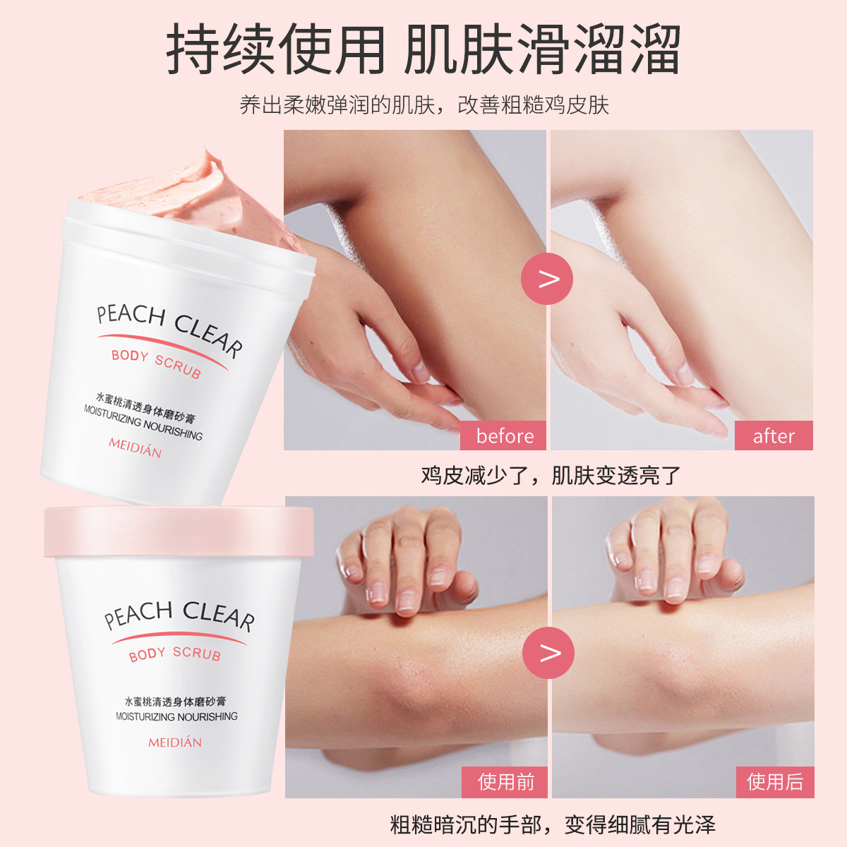 Meandian peach body scrub cream exfoliating peeling chicken skin dead skin deep cleansing ice cream scrub cream wholesale
