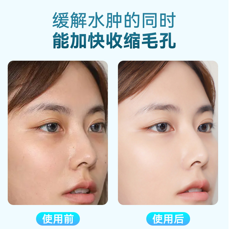 Ice compress instrument frozen age cold compress small ice hammer face lifting and tightening shrink pores