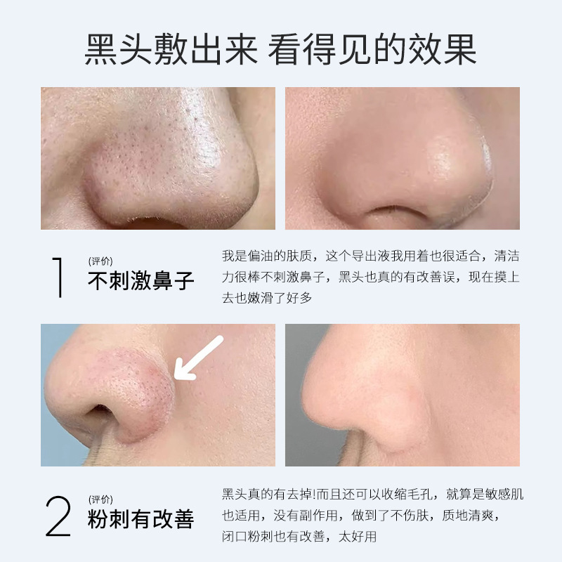 Beauty Salon Wholesale Special Skin Care Products Cinema Classy Whitening Head Acne Closed Mouth Shrinking Pores Blackhead Export Liquid
