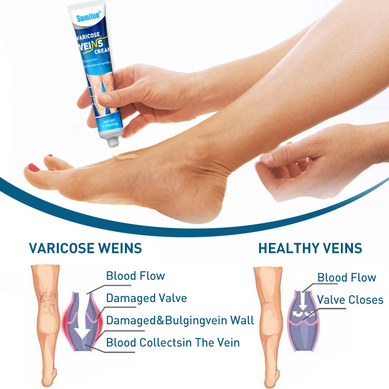 Sumifun Cross-Border Export Vein Cream Blue Vein Lishu Ointment Earthworm Leg Vein Cream 20Gk10025
