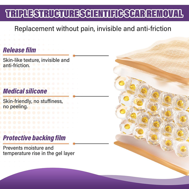 Cross-Border Skin Care Silicone Scar Removal Strips Soothes Skin Scars, Fever and Scald Skin Scars Cream