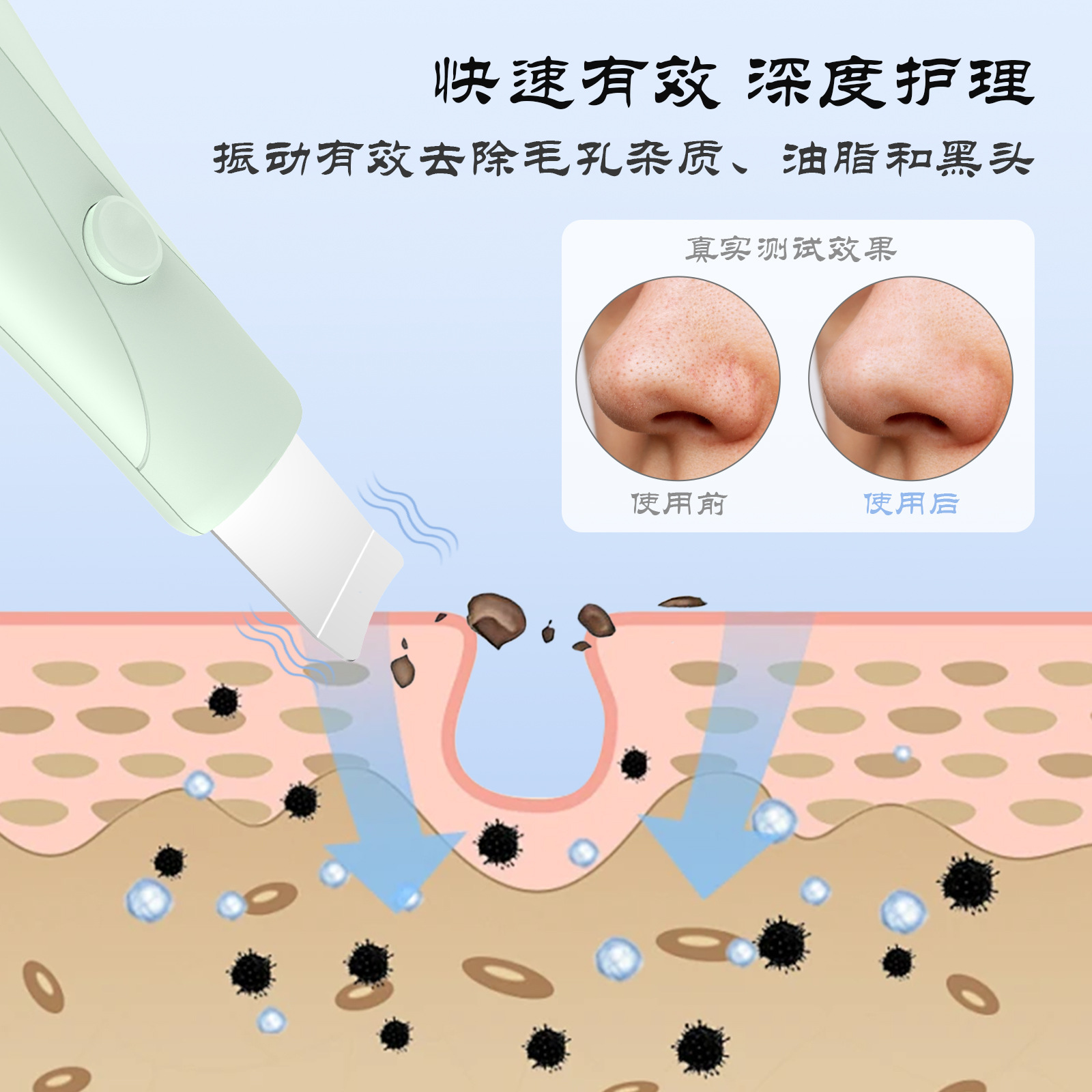 Cross-Border New Electric Blackhead Shovel Facial Household Blackhead Removal Pore Cleaning Portable Peeling Knife Beauty Instrument