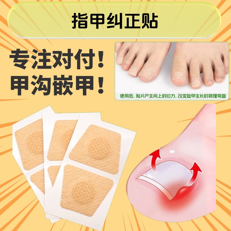 Патч для ухода за ногтями, защита от вросших ногтей, подушечка для пальцев, мягкий ортопедический патч при онихомикозе