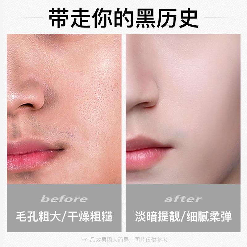 Ice chrysanthemum men's oil control net cool hydrating mask 10 boxed moisturizing brightening men's skin care products manufacturers on behalf of the hair