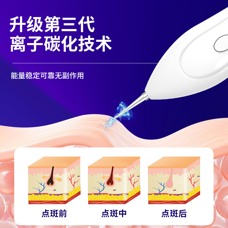 Mole Removal Pen for Home Use, German Small White Laser Beauty Device, Blue Light Spot Remover, Spot and Mole Removal Device