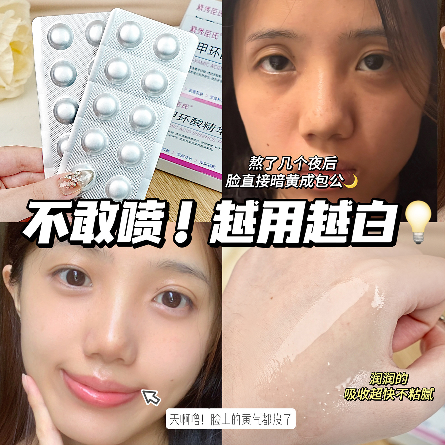Su Xiu Chen's Tranexamic Acid Essence Tablets for Improving Dull and Brightening Skin Color Moisturizing and Rejuvenating Freeze-dried Powder