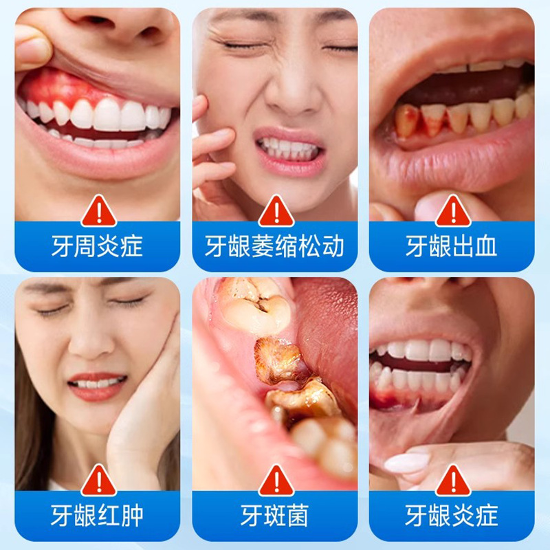 Sunflower Teeth Desensitizer Toothpaste Oral Care Desensitization Paste Dental Separator Bleeding Gums Anti-Allergic Toothpaste