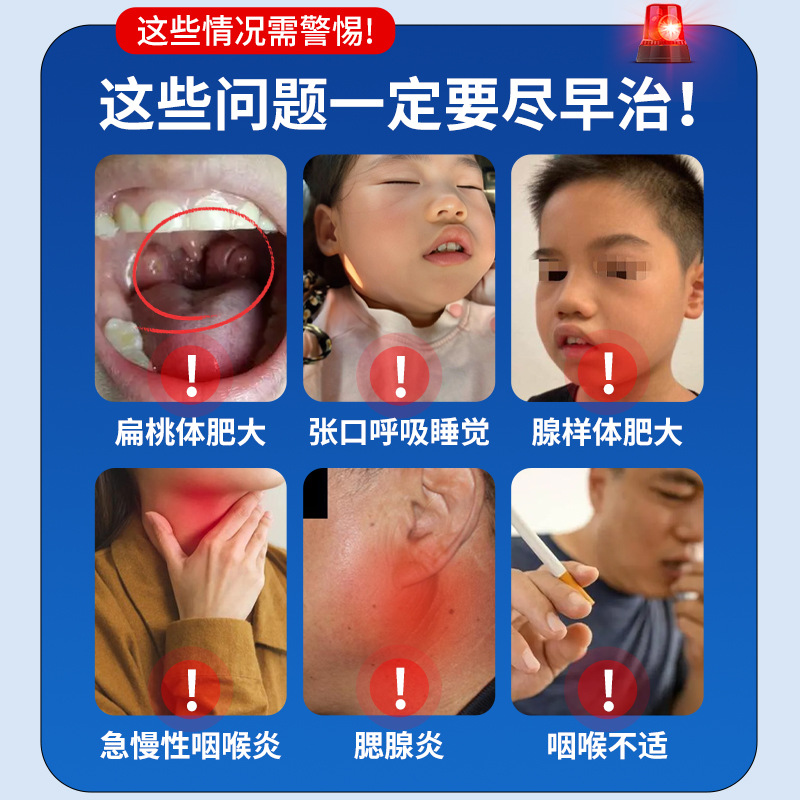 Yao Kang Ren Yan Bian Acupoint Magnetic Therapy Paste Improves Acute and Chronic Pharyngitis, Pharyngitis, Tonsil Inflammation, Adenoid Hypertrophy