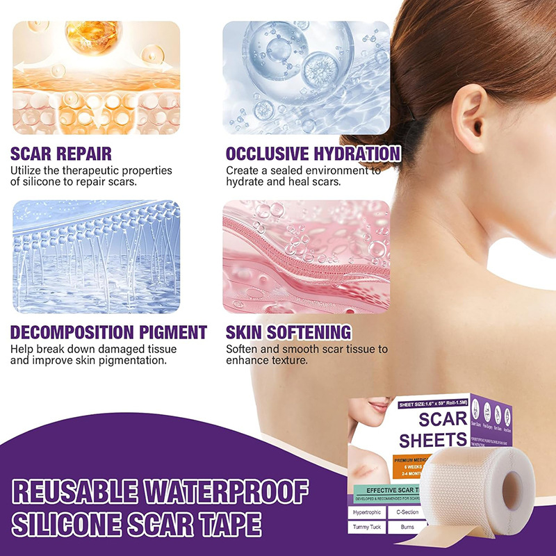 Cross-Border Skin Care Silicone Scar Removal Strips Soothes Skin Scars, Fever and Scald Skin Scars Cream
