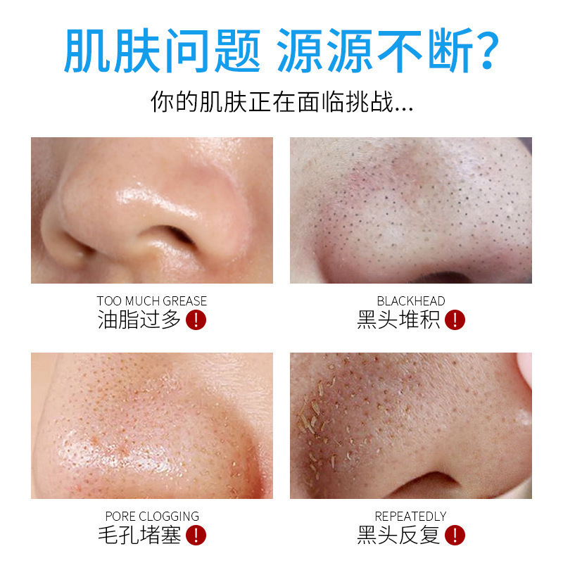 Blackhead Export Liquid Water Beauty Salon Special Hospital Size to Remove Blackheads and Acne Closed Mouth Cleansing Facial Care Essence