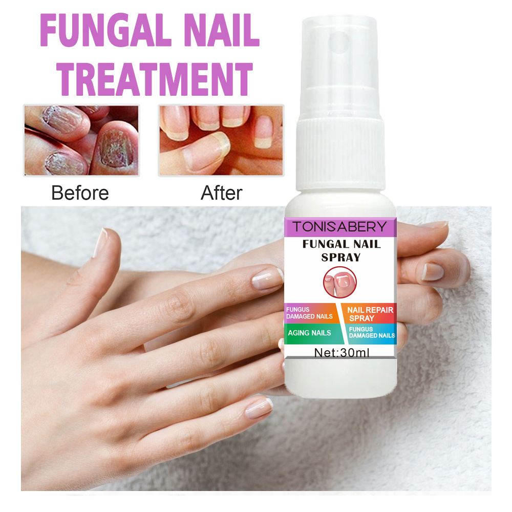 Amazon Aliexpress Tk Supply Onychomycosis Care Spray Repair Soft Nail Thickening Nail Cleansing Antibacterial Liquid