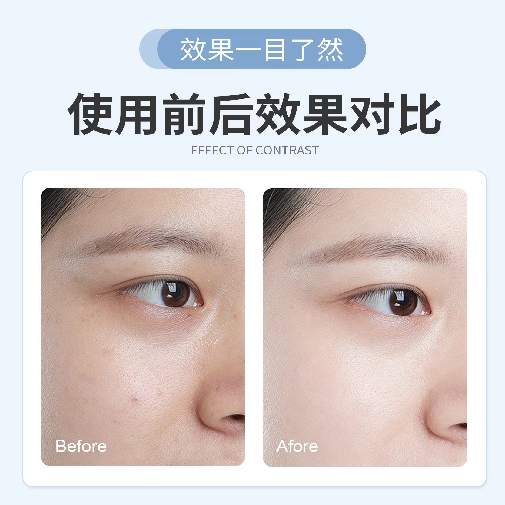 Mole Spot Pen, Beauty Salon Special Cross-Border Freckle Removal and Tattoo Removal Lcd 9-Speed Beauty Instrument Factory Wholesale Mole Removal Pen