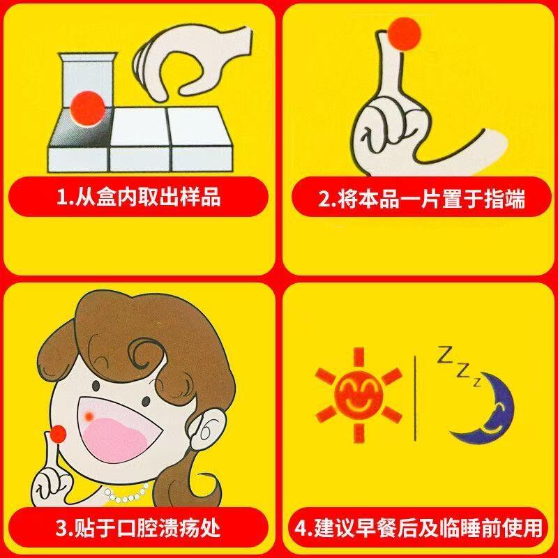 Chuangbang oral ulcer film 1.2cm * 9 round) oral ulcer caused by various reasons to relieve pain