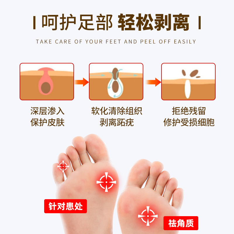 Foot Care Chicken Eye Patch Plaster Manufacturer Wholesale Ointment to Remove Foot Patch Anti-itch Chicken Eye Patch 6 Patch om Generation