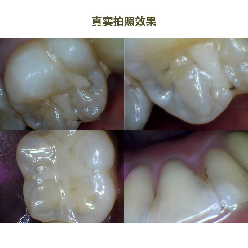 USB Oral Endoscope Hd Portable Oral Viewer Handle Endoscope Medical Teeth Photo