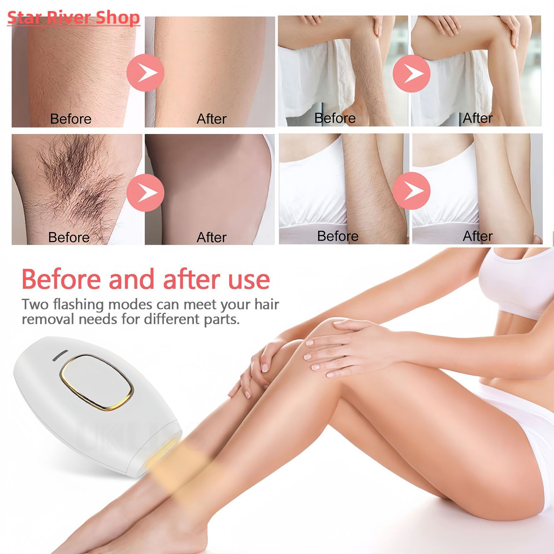 Cross-border IPL laser hair removal instrument household photon rejuvenation instrument body painless 881 hair removal instrument factory direct sales