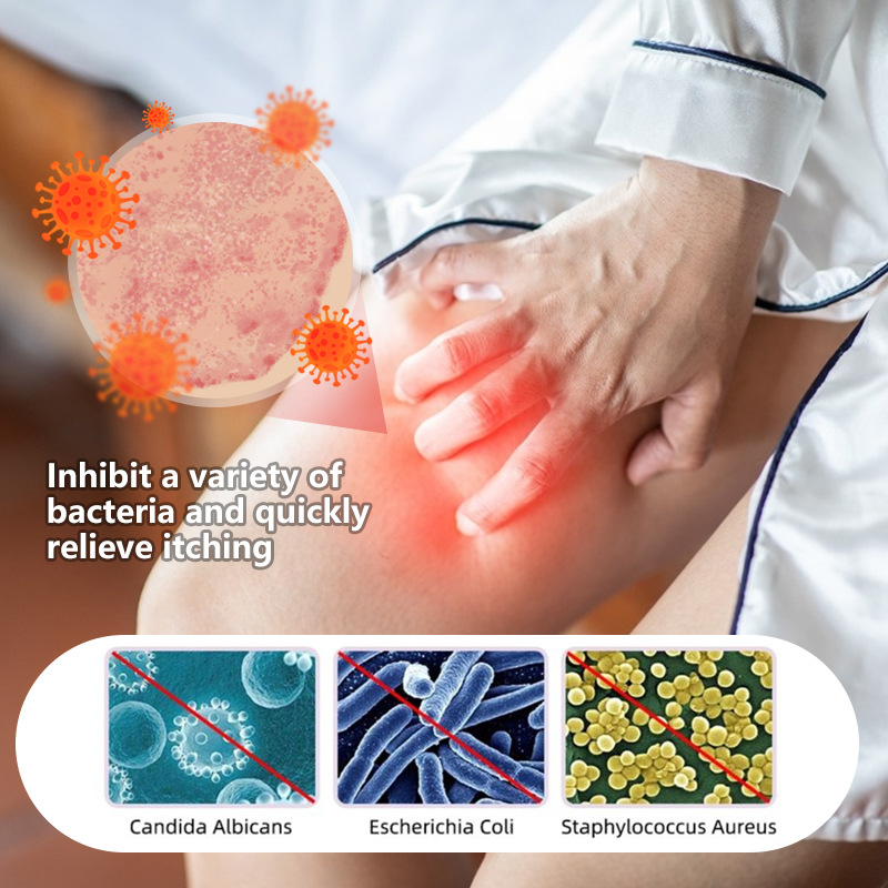 Sumifun Cross-Border Supply Vaginal Itch Cream Private Care Cream Skin Ointment External Use Source Brand K10022