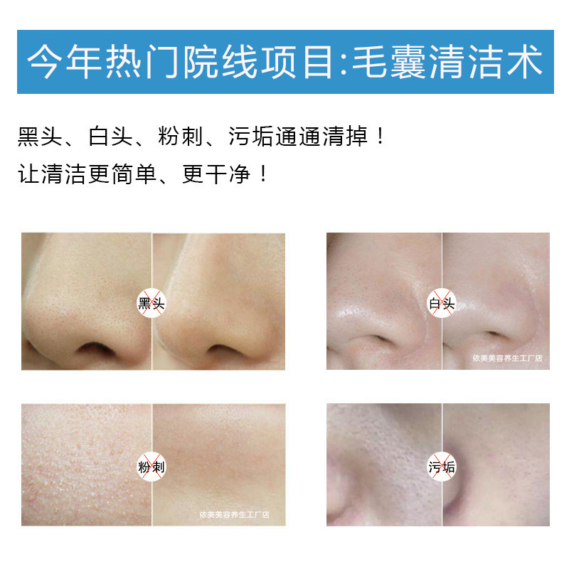 Beauty salon special pore cleansing cream to remove blackheads and acne to clean facial hair follicle dirt clogging facial massage cream