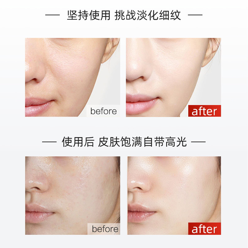 Hot-Selling Popular Lanjimei Kidsren's Facial Collagen Cannon Infusion Mask Protein Hydrating Moisturizing Firming Anti-Wrinkle Moisturizing