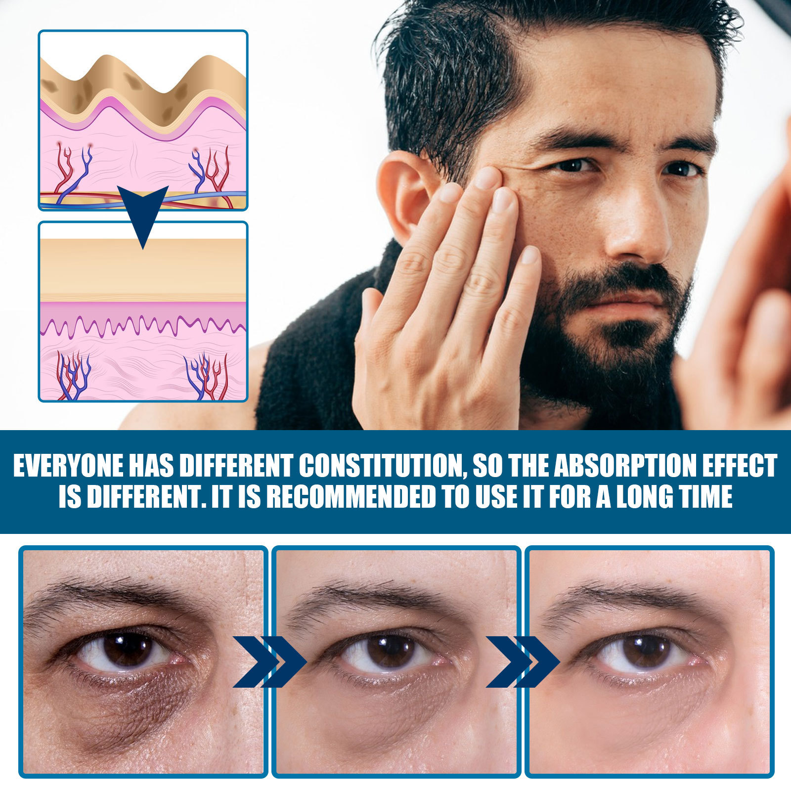 East Moon Men's Anti-Aging Eye Cream to Reduce Wrinkles, Fade Dark Circles, Moisturizing and Tightening Eye Cream