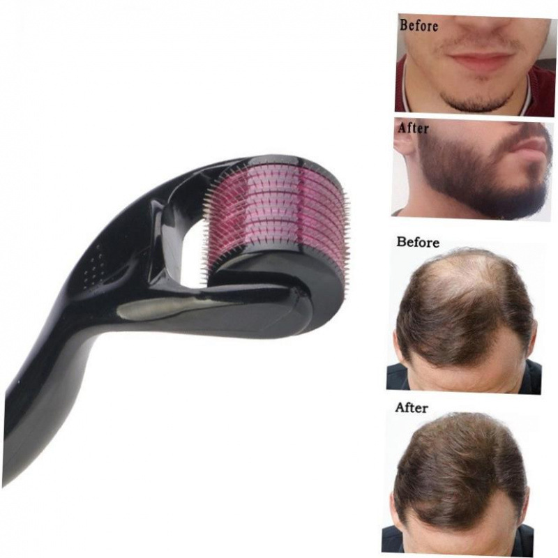 Микронедлинг 540 Роллер, дерма-роллер 0.2/0.25/